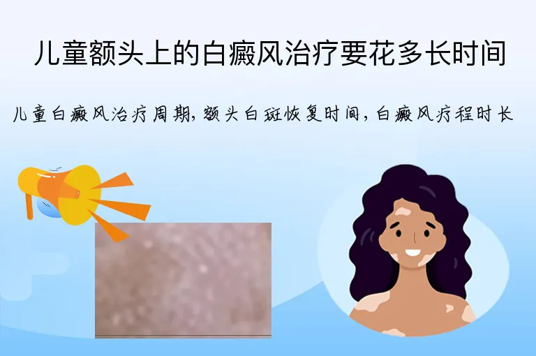 儿童额头上的白癜风治疗要花多长时间