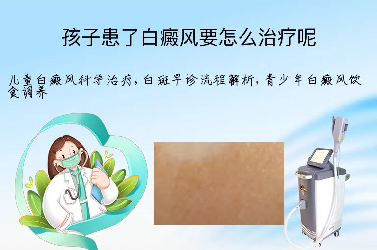 孩子患了白癜风要怎么治疗呢