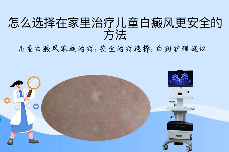 怎么选择在家里治疗儿童白癜风更安全的方法