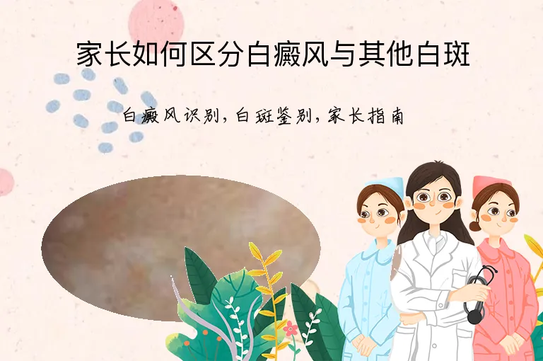 家长如何区分白癜风与其他白斑