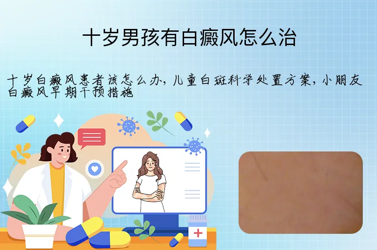 十岁男孩有白癜风怎么治
