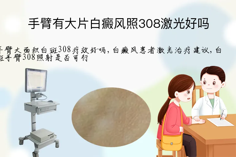 手臂有大片白癜风照308激光好吗