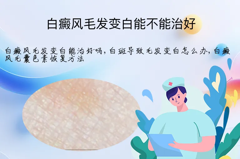 白癜风毛发变白能不能治好