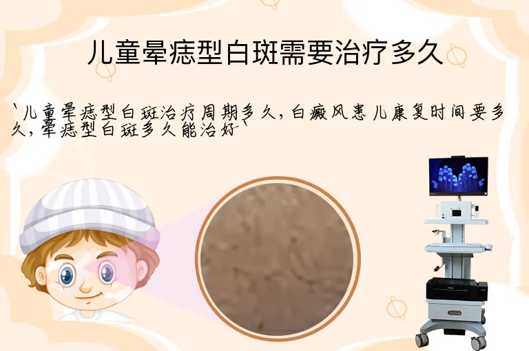 儿童晕痣型白斑需要治疗多久