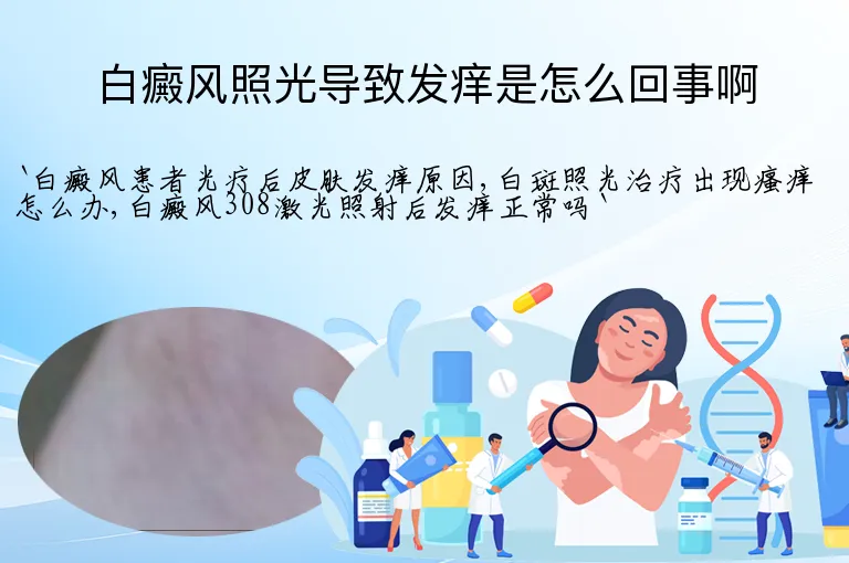 白癜风照光导致发痒是怎么回事啊