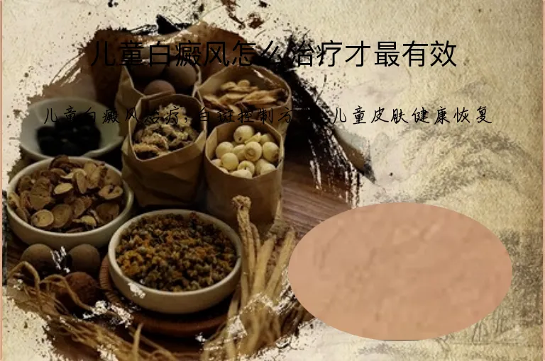 儿童白癜风怎么治疗才最有效