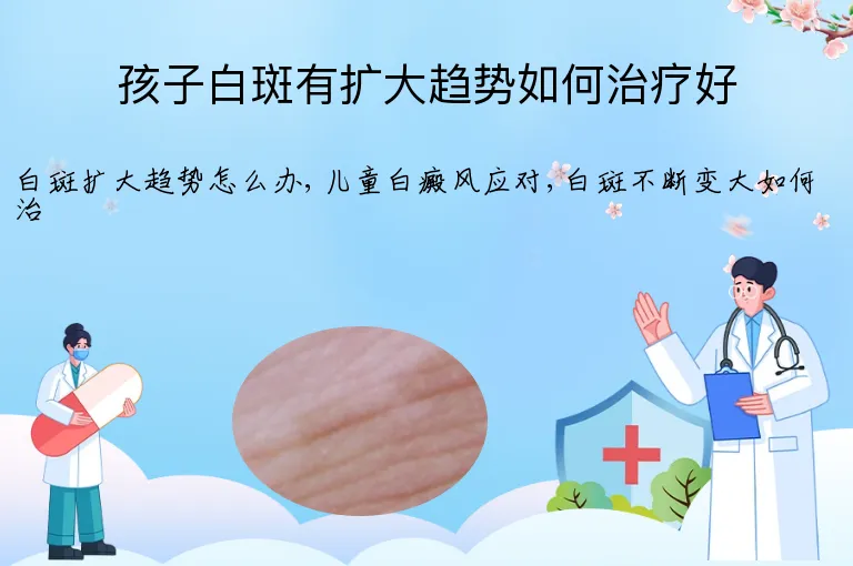 孩子白斑有扩大趋势如何治疗好