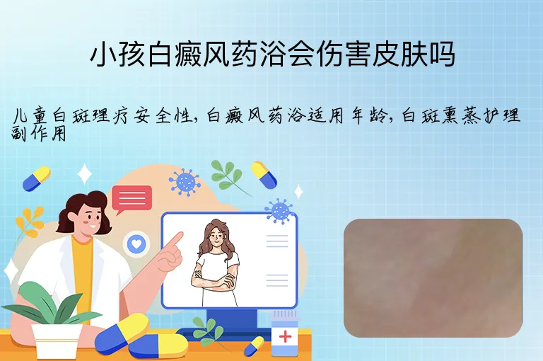 小孩白癜风药浴会伤害皮肤吗