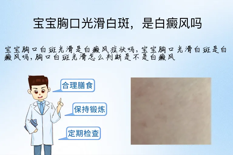 宝宝胸口光滑白斑,是白癜风吗