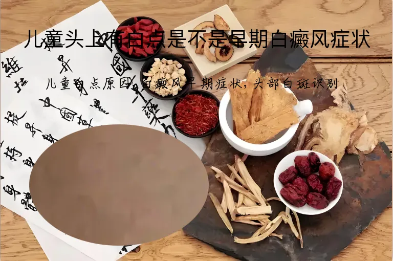 儿童头上有白点是不是早期白癜风症状