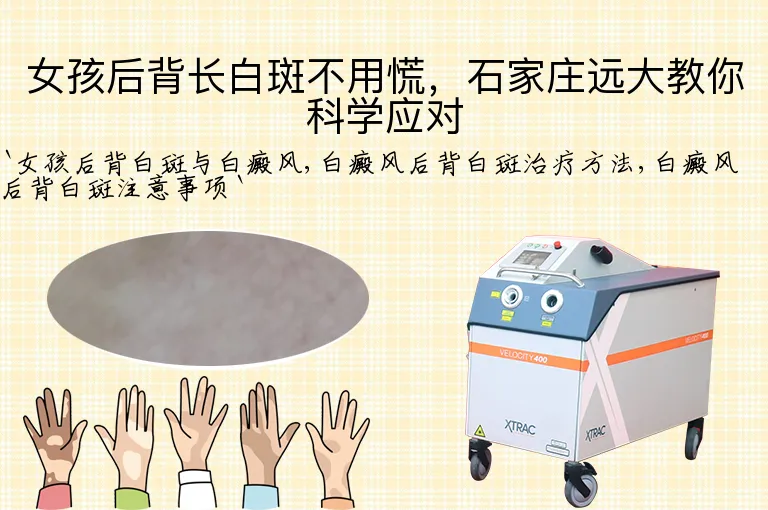 女孩后背长白斑不用慌，石家庄远大教你科学应对