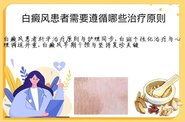 白癜风患者需要遵循哪些治疗原则