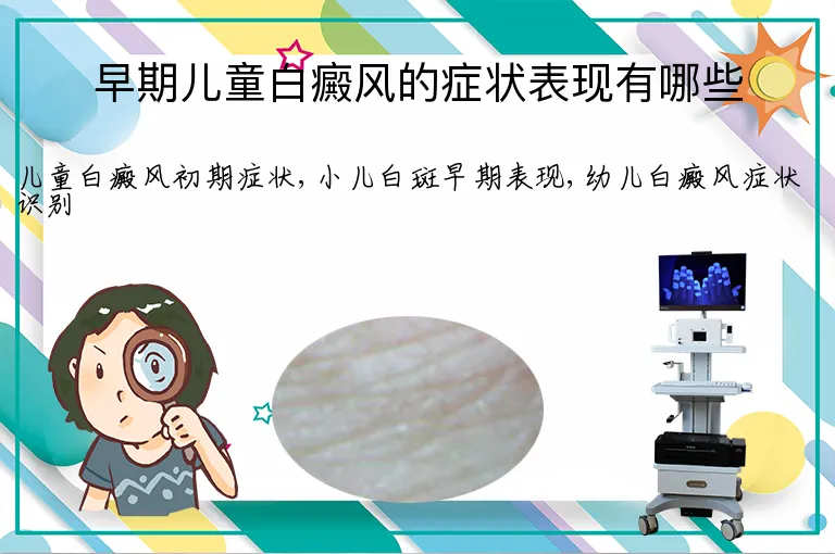 早期儿童白癜风的症状表现有哪些