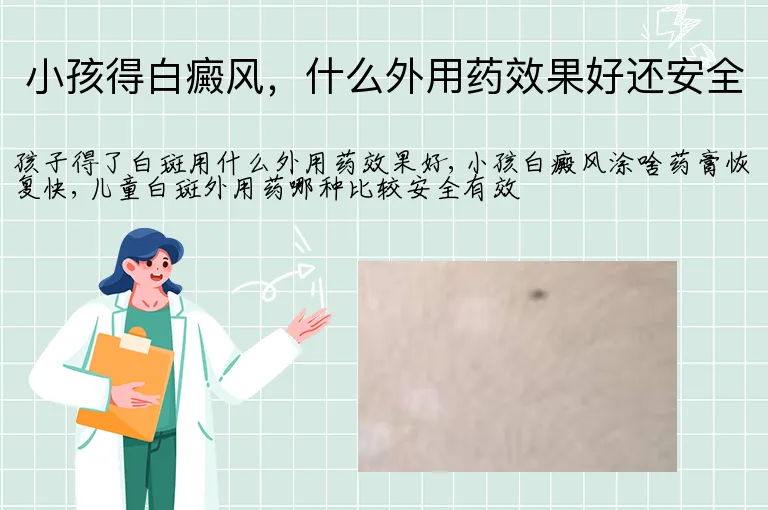 小孩得白癜风，什么外用药效果好还安全