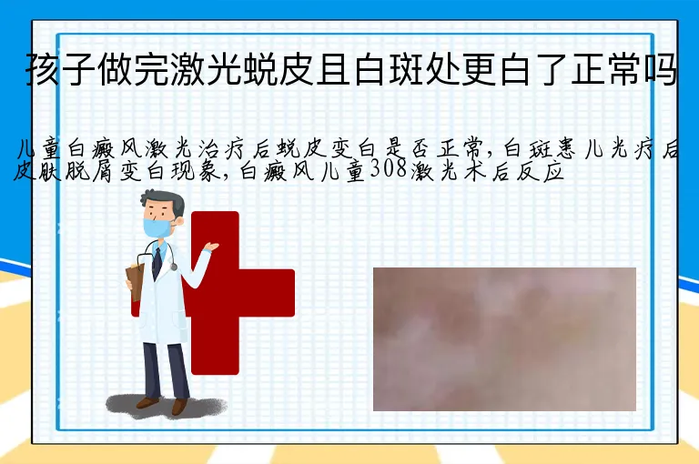 孩子做完激光蜕皮且白斑处更白了正常吗