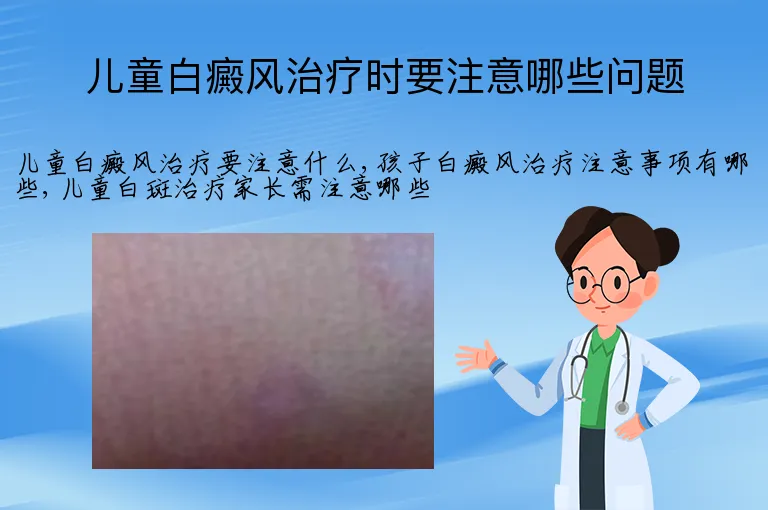 儿童白癜风治疗时要注意哪些问题
