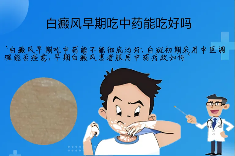 白癜风早期吃中药能吃好吗