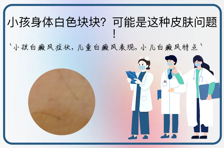 小孩身体白色块块？可能是这种皮肤问题！