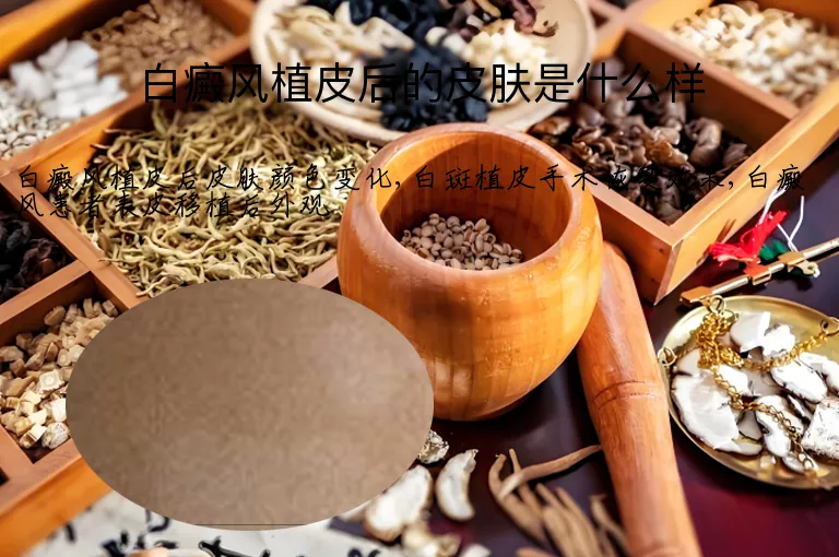 白癜风植皮后的皮肤是什么样
