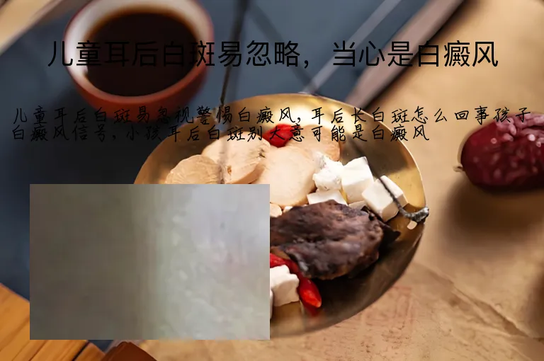 儿童耳后白斑易忽略,当心是白癜风