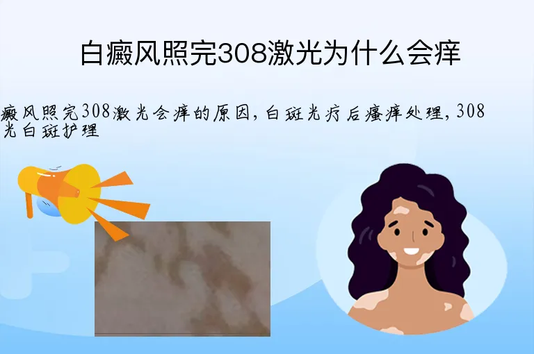 白癜风照完308激光为什么会痒