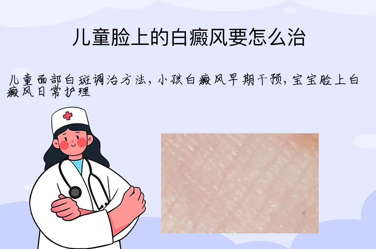 儿童脸上的白癜风要怎么治
