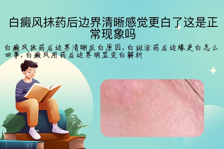 白癜风抹药后边界清晰感觉更白了这是正常现象吗