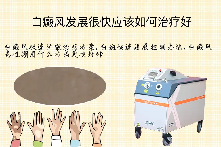 白癜风发展很快应该如何治疗好