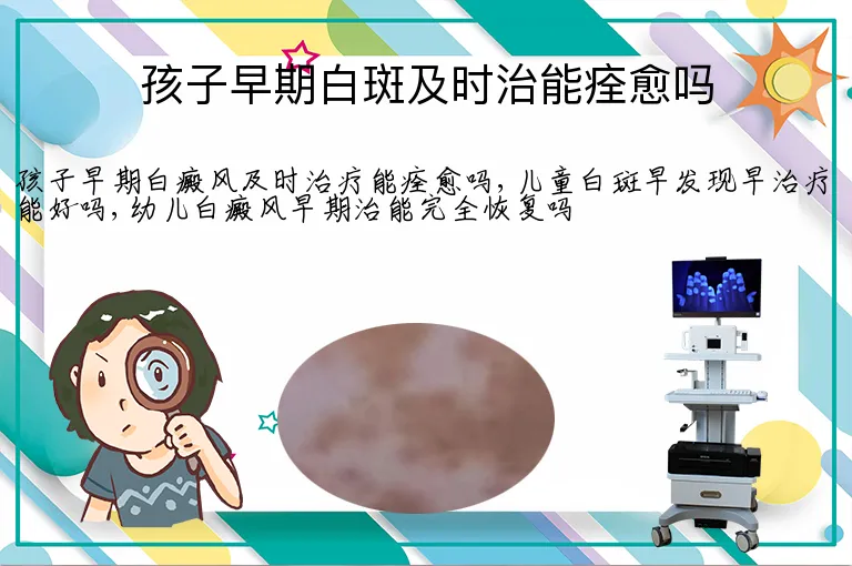 孩子早期白斑及时治能痊愈吗