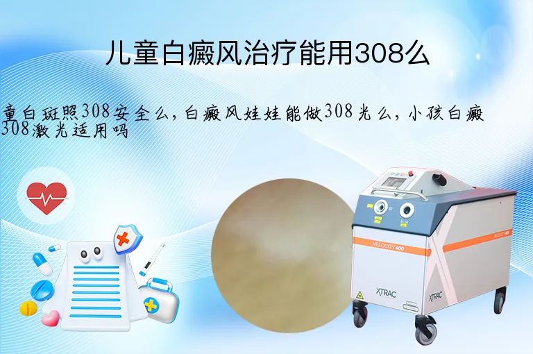 儿童白癜风治疗能用308么