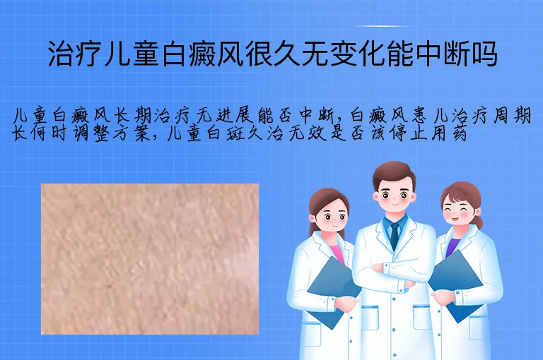 治疗儿童白癜风很久无变化能中断吗