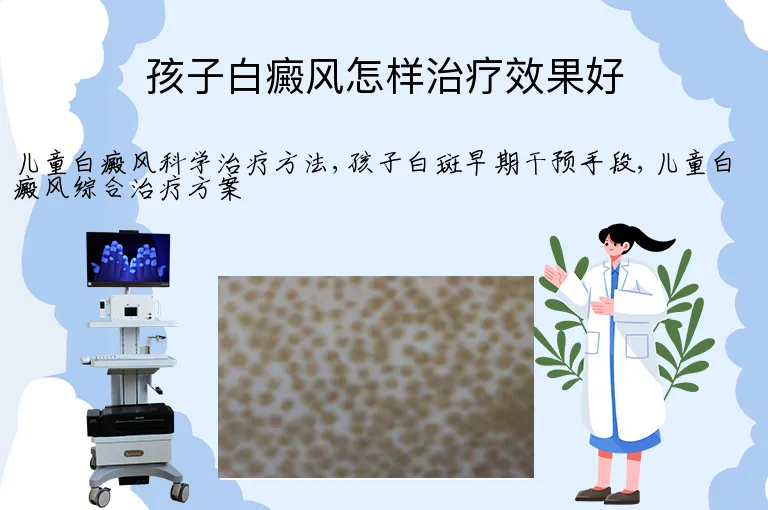孩子白癜风怎样治疗效果好