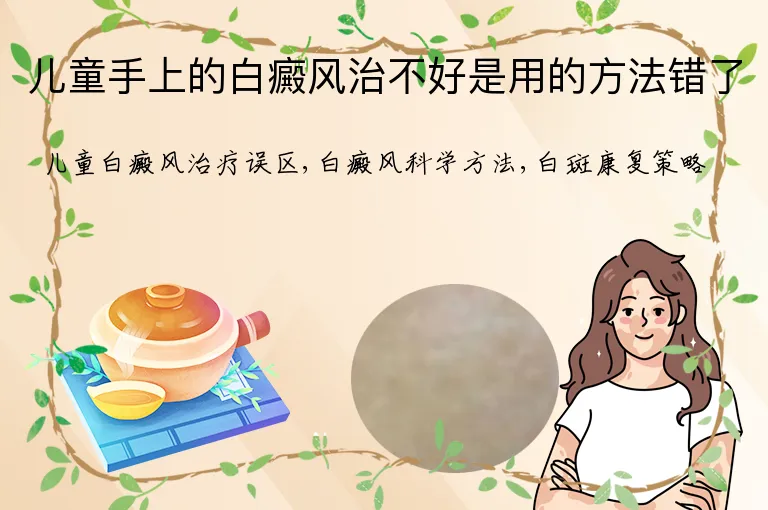 儿童手上的白癜风治不好是用的方法错了