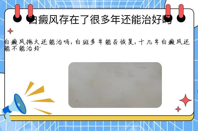 白癜风存在了很多年还能治好吗