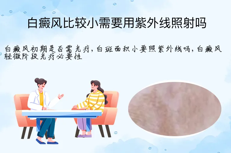 白癜风比较小需要用紫外线照射吗