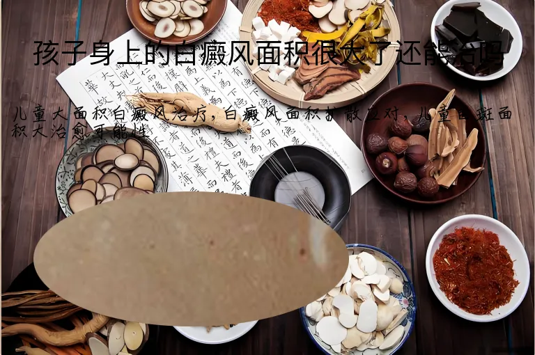 孩子身上的白癜风面积很大了还能治吗