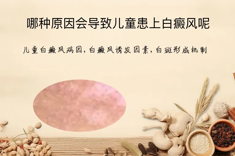 哪种原因会导致儿童患上白癜风呢