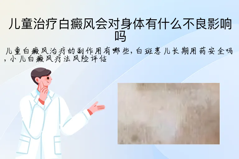 儿童治疗白癜风会对身体有什么不良影响吗