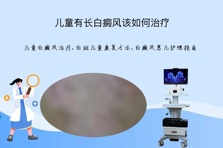 儿童有长白癜风该如何治疗