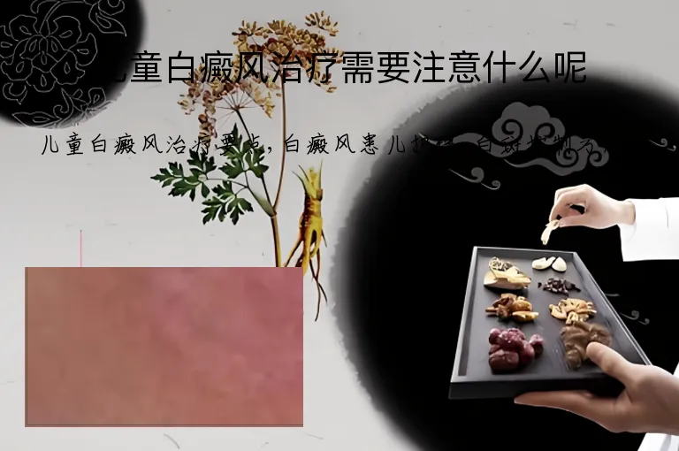 儿童白癜风治疗需要注意什么呢