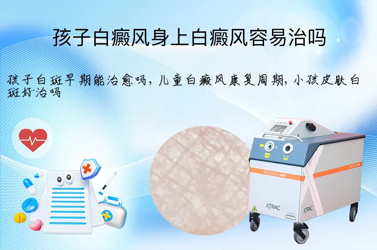 孩子白癜风身上白癜风容易治吗
