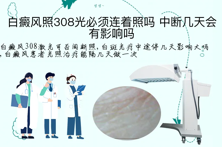 白癜风照308光必须连着照吗 中断几天会有影响吗