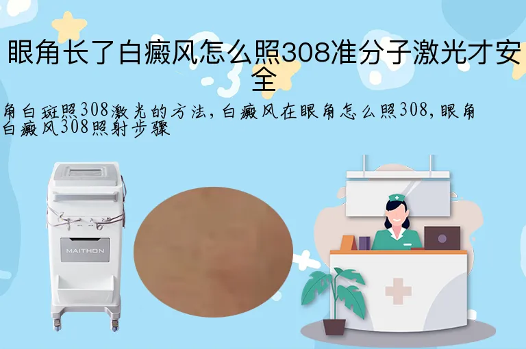 眼角长了白癜风怎么照308准分子激光才安全