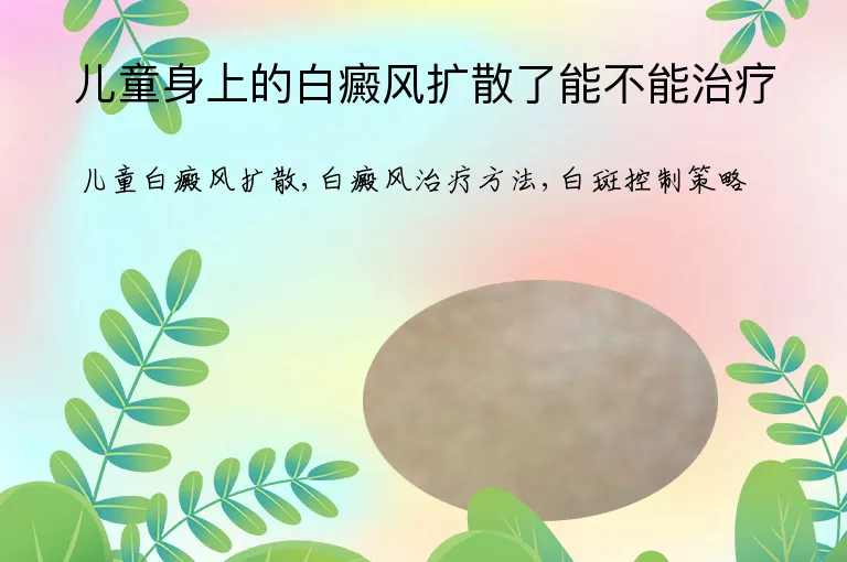 儿童身上的白癜风扩散了能不能治疗