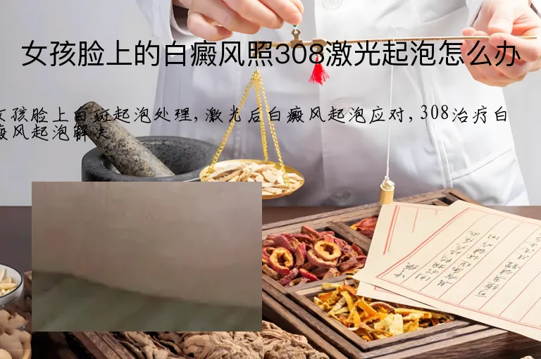 女孩脸上的白癜风照308激光起泡怎么办