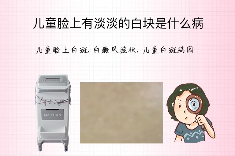 儿童脸上有淡淡的白块是什么病