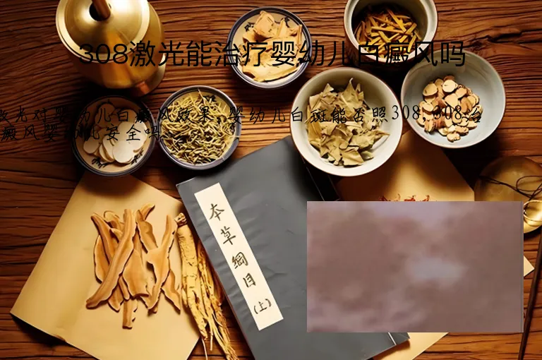 308激光能治疗婴幼儿白癜风吗