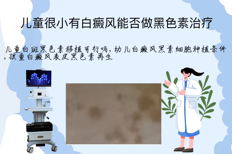 儿童很小有白癜风能否做黑色素治疗