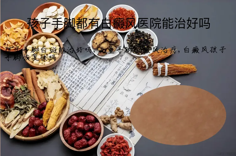 孩子手脚都有白癜风医院能治好吗