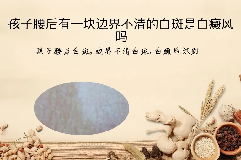 孩子腰后有一块边界不清的白斑是白癜风吗